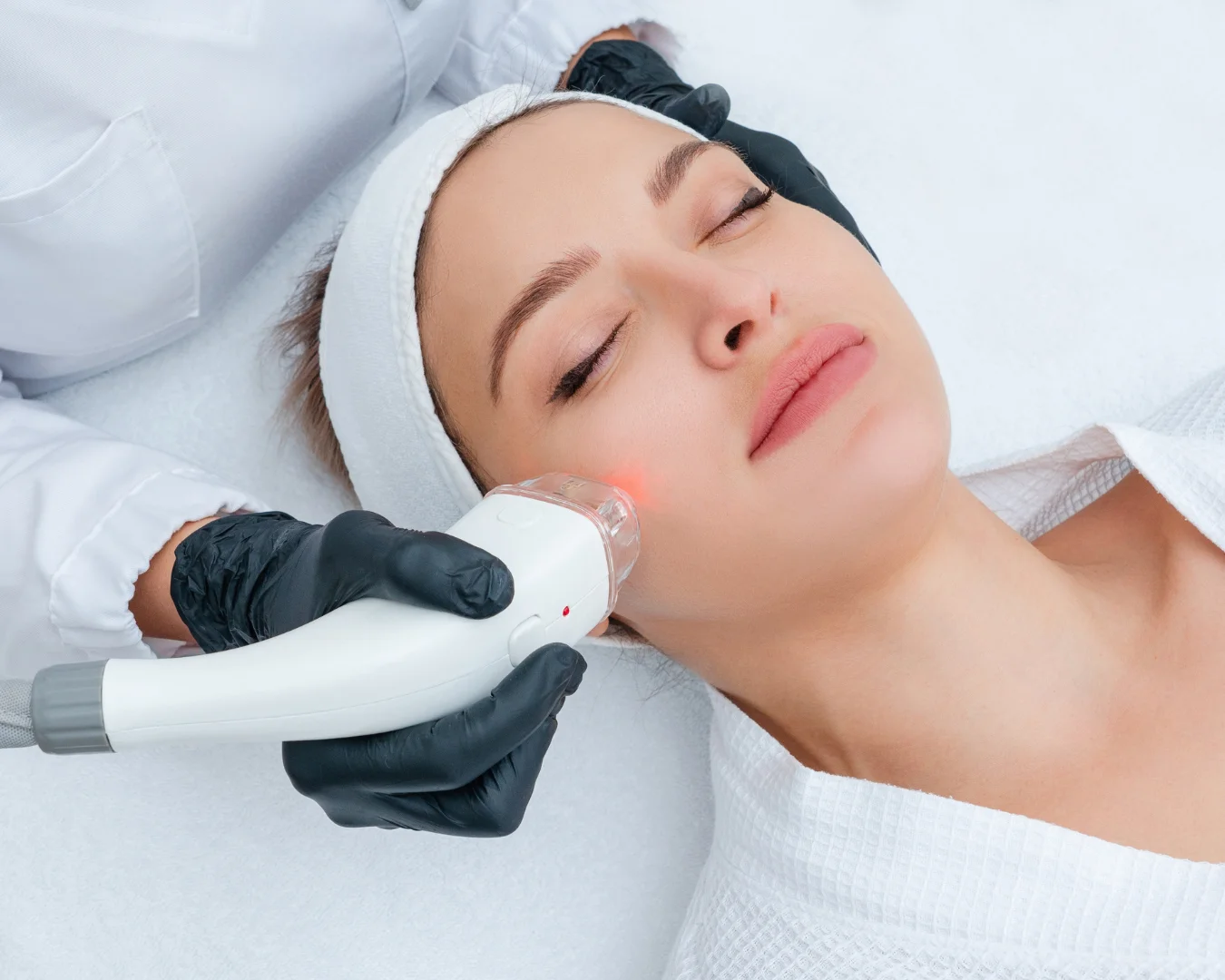 Tratamento de rejuvenescimento facial com laser